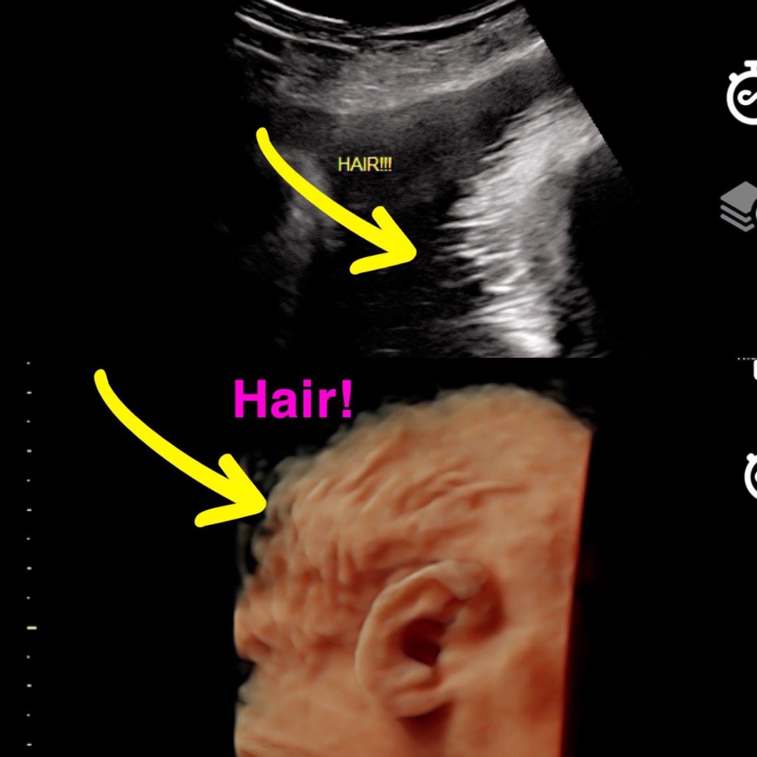 treasured moments 4d ultrasounds los angeles treasured moments 4d ultrasounds los angeles