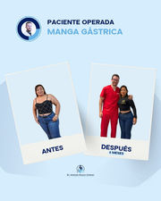 Antes y después de manga gástrica en León Guanajuato.
