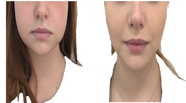 Captura_de_Tela_2020-03-06_aÌs_03.22.45