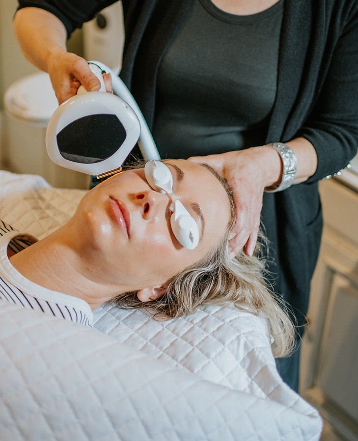 IPL PHOTOFACIALS - LUMECCA