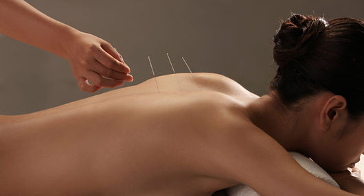 What is Acupuncture.jpg