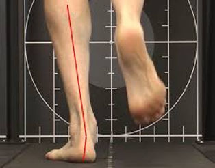 biomechanics, gait assessments