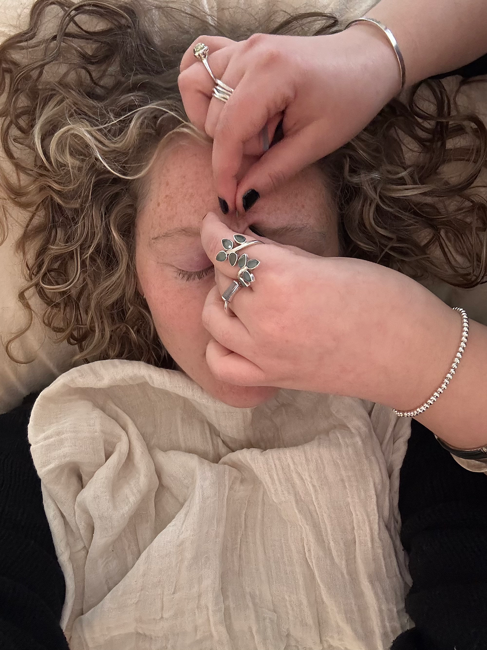 Sara Lacey from SJL Acupuncture needling the yintang point on her female patient's forehead