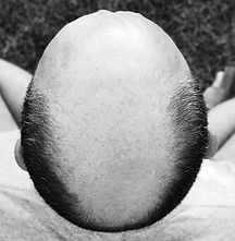 how-shave-bald-head-1516196127.jpg