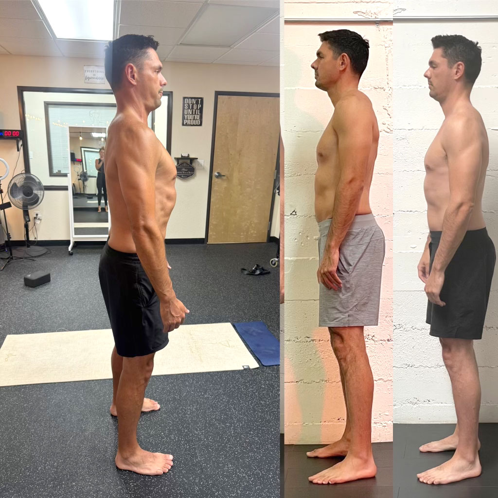 Before and after posture correction 1