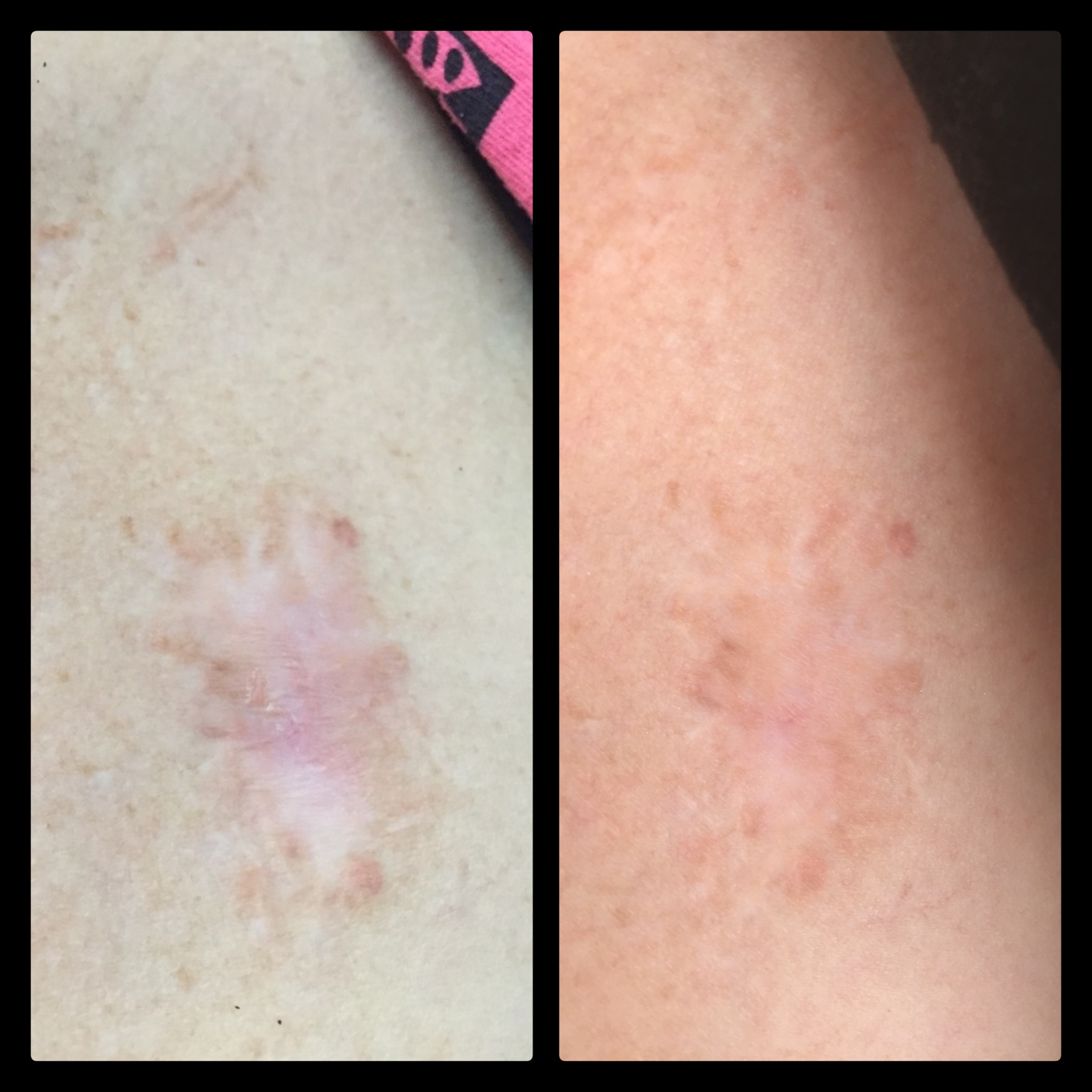 before and after color match