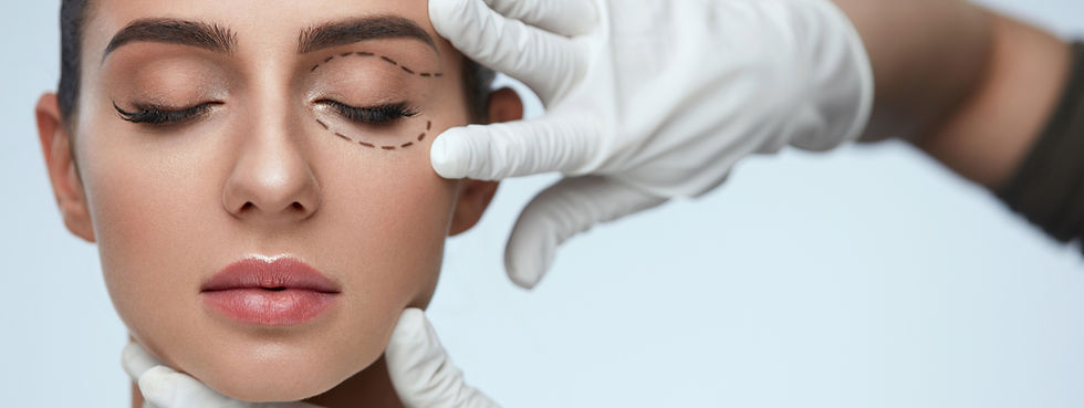 Diagnostic préalable pour une blépharoplastie supérieure et inférieure