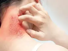 Person scratching red, irritated rash on neck with fingers. Skin appears inflamed. Background is plain white. Mood suggests discomfort.