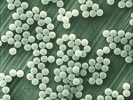 Separare le nanoparticelle dal sangue con un campo elettrico