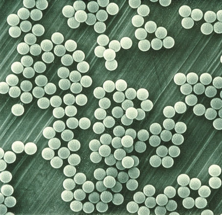 Separare le nanoparticelle dal sangue con un campo elettrico