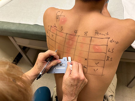 BK Skin Prick Test_NoBrand.2.jpg