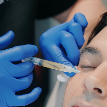What is a "vampire facial" —and what is it actually called?