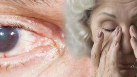 Vestibular Function in the Elderly