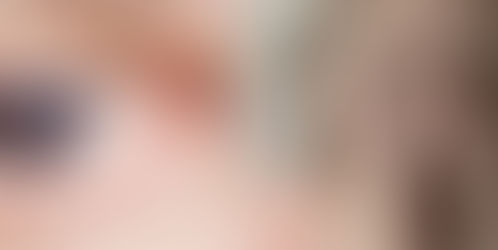 Vestibular Function in the Elderly