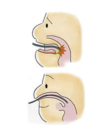 胃カメラ大腸カメラ