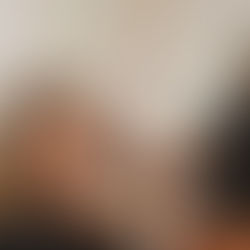 Jowling Treatment Using BOTOX® | Nurse Sam