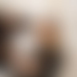 HIFU vs Ultherapy: Your Guide to Non-Surgical Skin Lifting