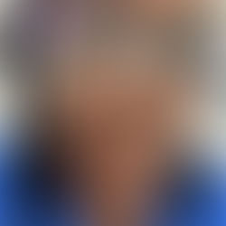 My pimple got so much airtime on the gram. Gross or Bold AF?