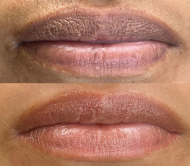 Neutralización de labios
