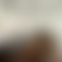 Introduction to Enhanced External Counterpulsation (EECP): What Every Patient Should Know