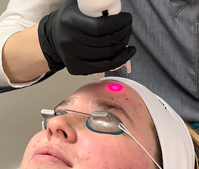 Sculptra en huidtherapie: een goede combi?