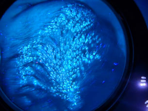 Infecções Fúngicas no Couro Cabeludo em Bebês: Como Identificar e Tratar de Forma Eficaz