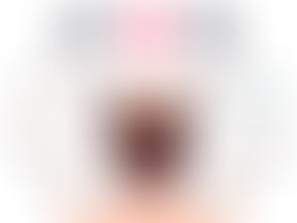 From Confidence Lost to Confidence Regained With Hair Transplant For Men