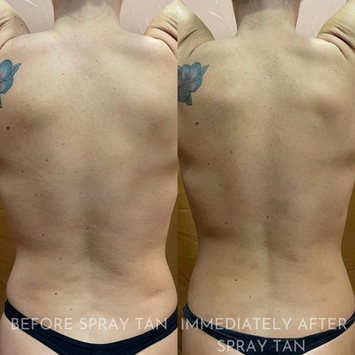 Top Rated Orange County Airbrush Spray Tan, Best Orange County Airbrush Spray Tan, Orange County Spray Tan Party, Orange County Spray Tan Parties, Orange County Wedding Spray Tan, Orange County Bridal Spray Tan, Orange County Celebrity Spray Tan