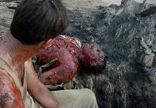 Burned Body