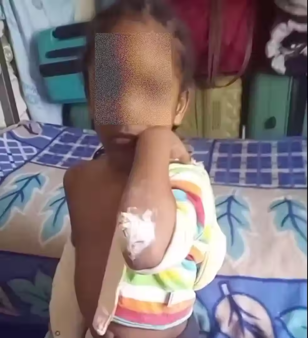 Lily’s son shows a wound on his elbow. She says her children live with filth and constant mosquito bites. Credit: The Guardian, Handout