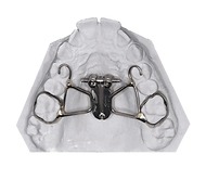spider-rpe-live-dental-studio-ottawa