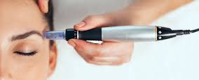 The Ultimate Guide to Microneedling: Collagen Stimulation, Skin Renewal & Advanced Add-Ons
