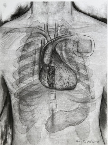 Pacemaker | Freemansawyerart.com