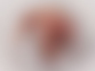 Surge in U.S. Infant Mortality Rate: A 20-Year High, CDC Reports