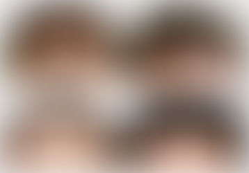 hair transplant Islamabad