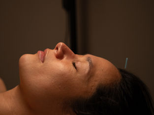 What’s Actually Happening During Cosmetic Acupuncture?