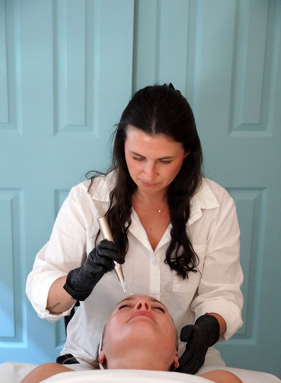 Holistic Microneedling at Acupunctury