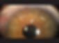 IndianJOphthalmol_2016_64_3_206_181740_f4.jpg