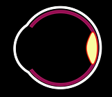 Wet Age Related Macular Degeneration
