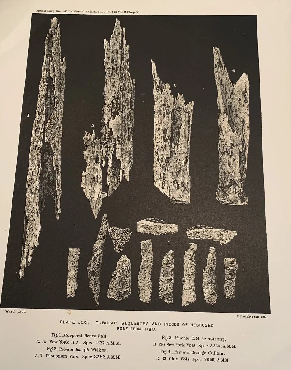 Thumbnail: Six (6) Period Medical Prints of Wounds and Amputations Some Identified