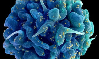 hiv belirtileri