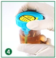 İdrar Örneği Nasıl Verilir?