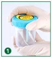 İdrar Örneği Nasıl Verilir?