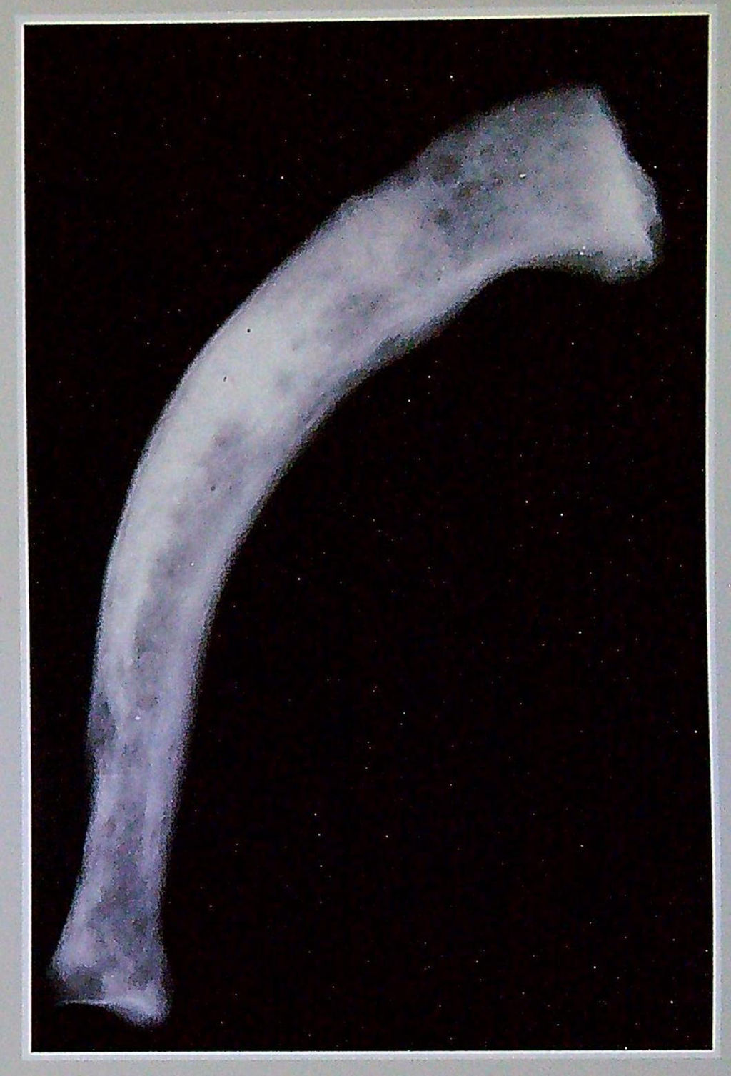 Docteur Daniel Lefèbvre Rhumatologie Arlon Belgique