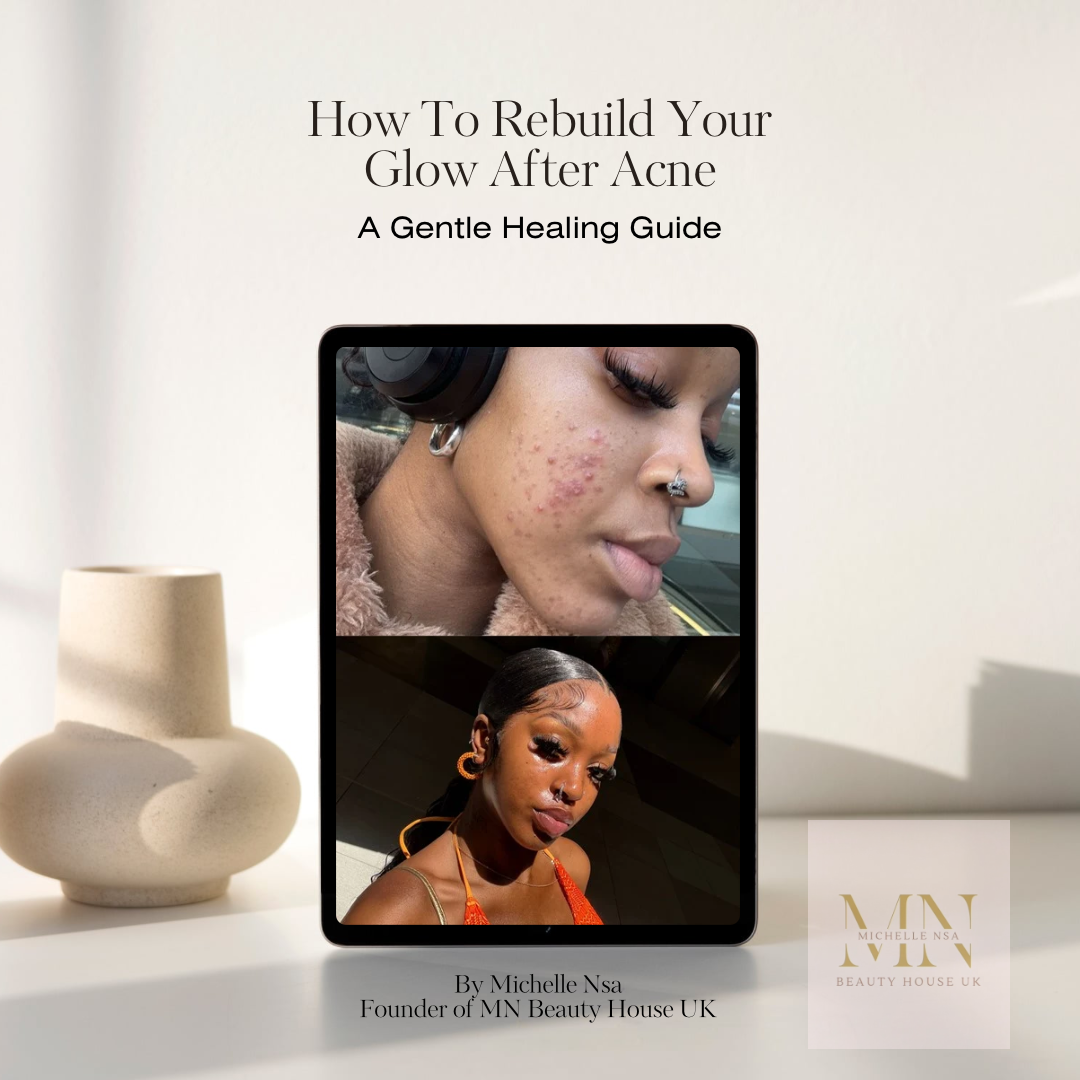 How To Rebuild Your Glow After Acne
