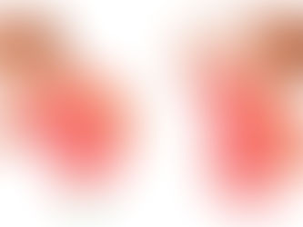 نزيف الانف وازاي نتصرف معاه بشكل صحيح باذن الله 👌🏻🤍