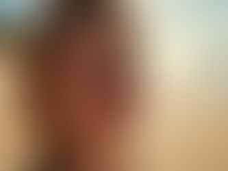 Understanding Skin Pigmentation in Australia and Top Strategies for Achieving Radiant Skin