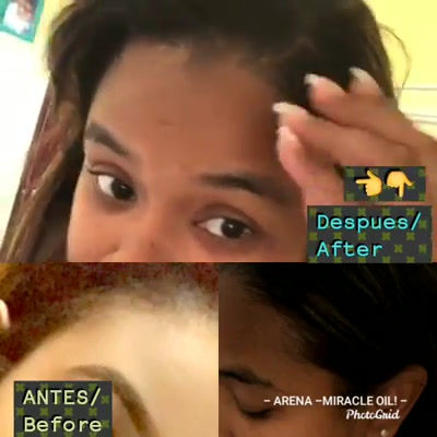 Thumbnail: BUY 2 ARENA HAIR OIL FOR $35.00