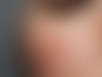 生理期前長粉刺怎麼辦?月經前下巴爆痘原因與5個保養重點|真楨美學
