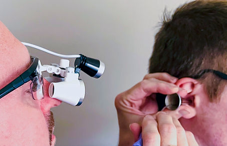 what is microsuction?